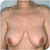Photo1a